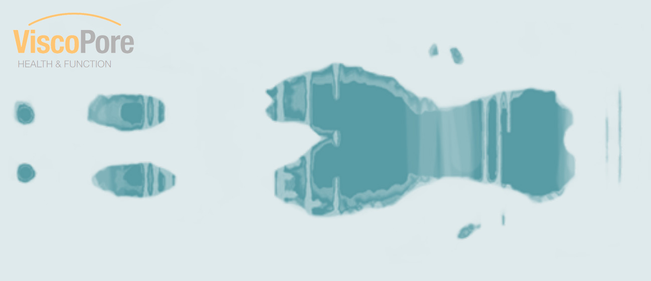 rozlozeni-tlaku-ViscoPore